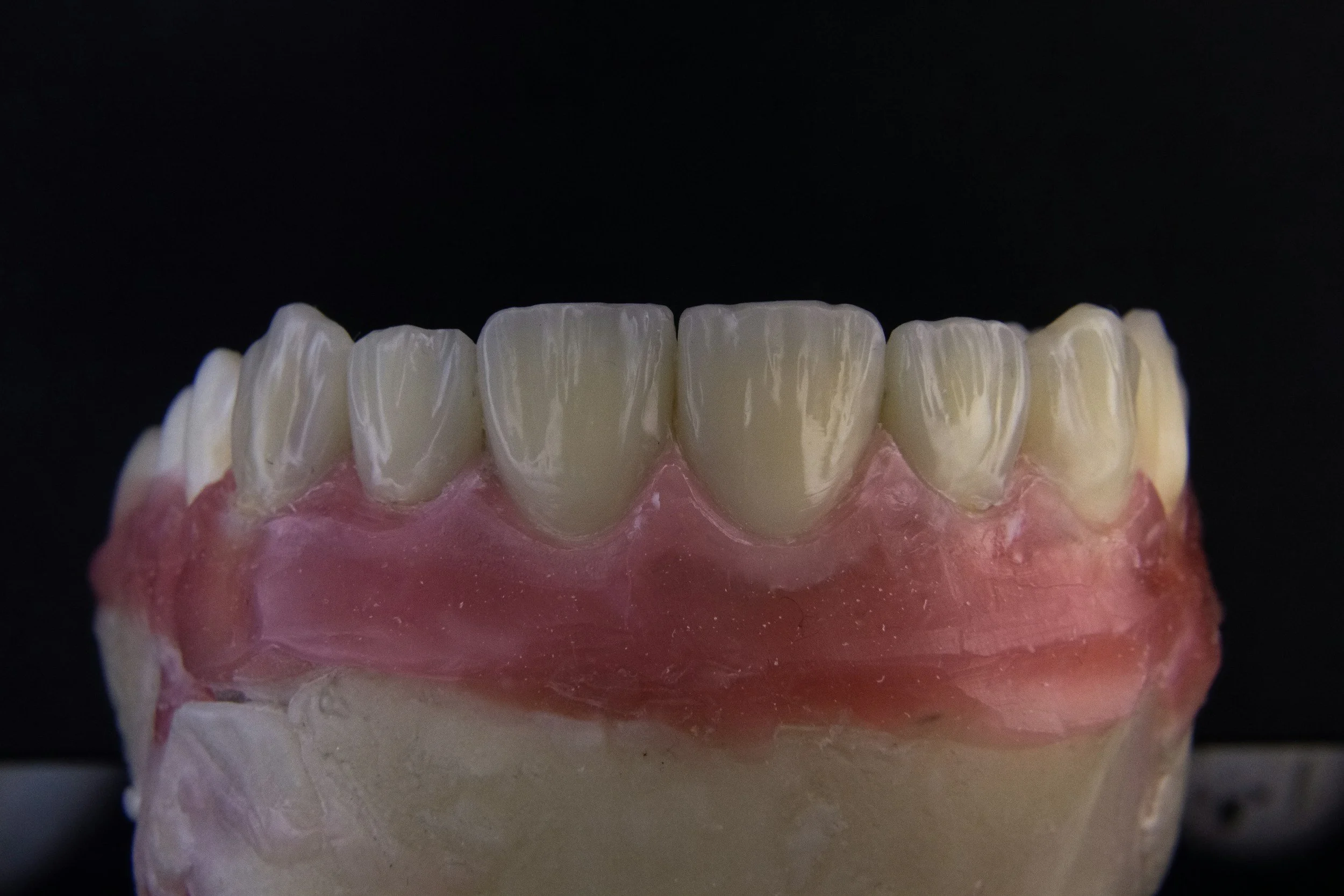 Patient discussing personalized dental implant treatment options with Dr. Jaffari